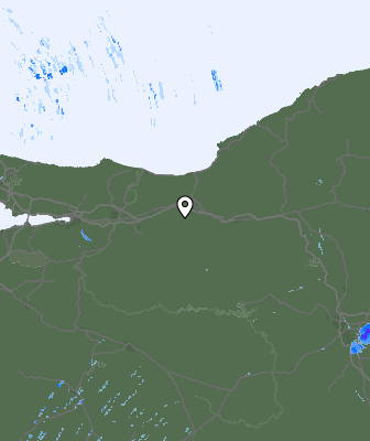 Radar