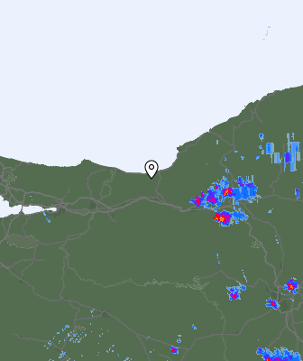 Radar