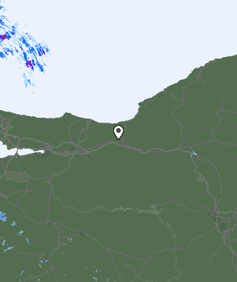 Radar