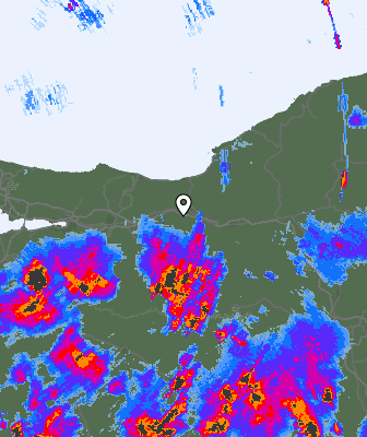 Radar