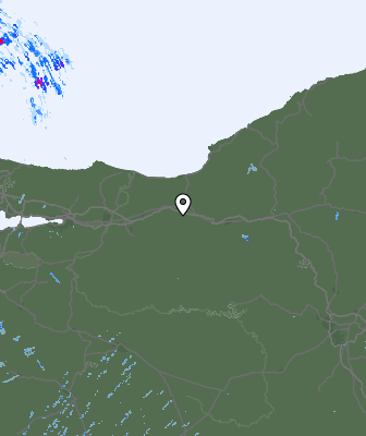 Radar