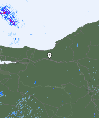 Radar
