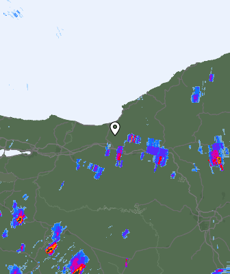 Radar