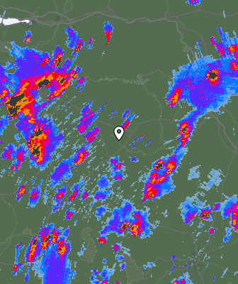Radar