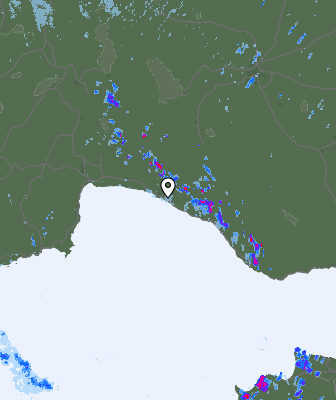 Radar