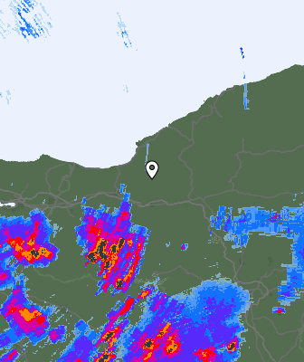 Radar