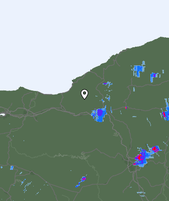 Radar