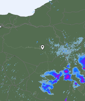 Radar