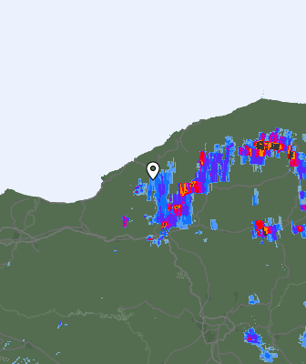 Radar