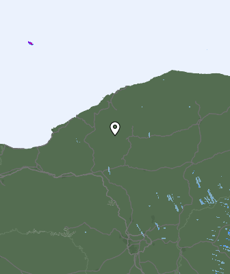Radar