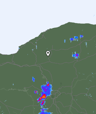 Radar