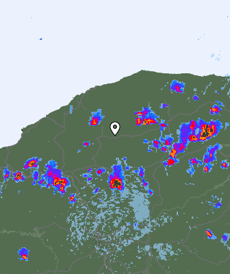 Radar