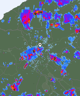 Radar
