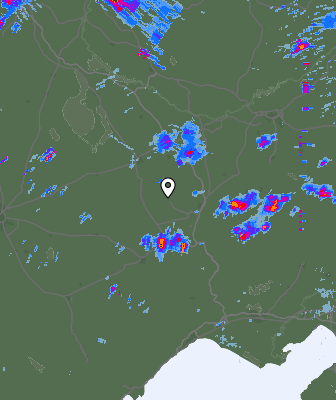Radar