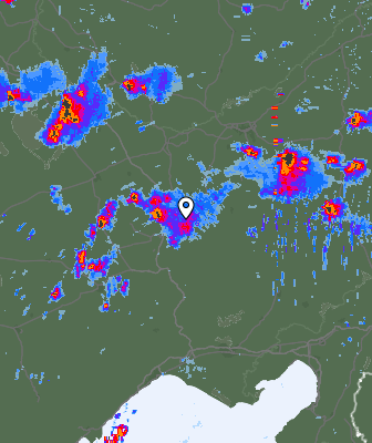 Radar