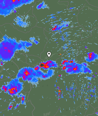 Radar
