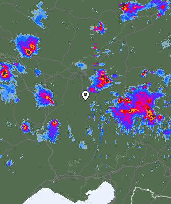 Radar