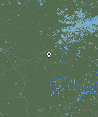 Radar