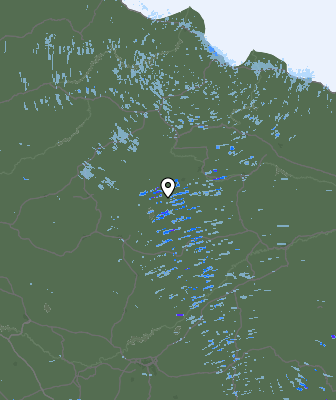 Radar