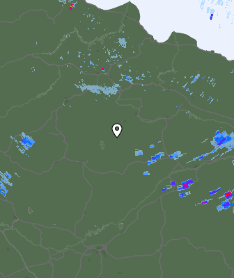 Radar