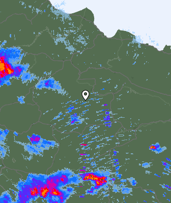 Radar