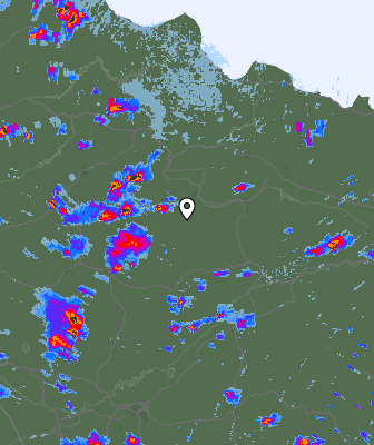 Radar