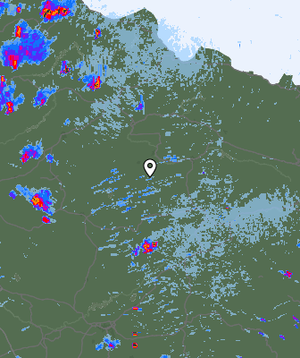 Radar