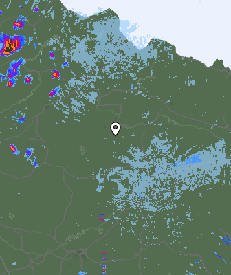 Radar