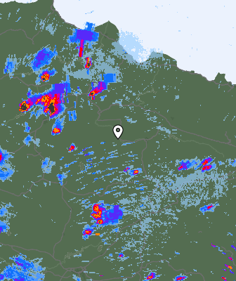 Radar