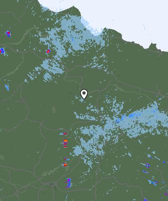 Radar