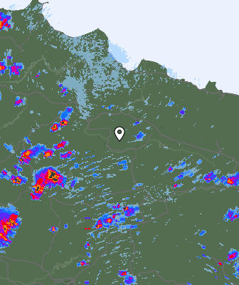 Radar