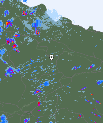 Radar