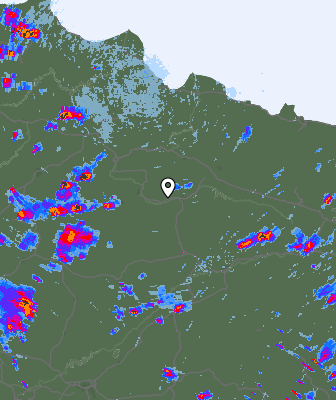 Radar