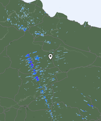 Radar