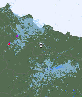 Radar