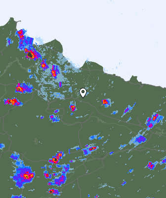 Radar