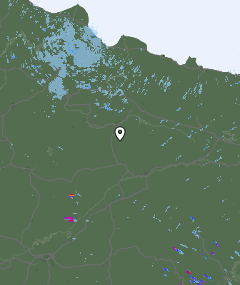 Radar