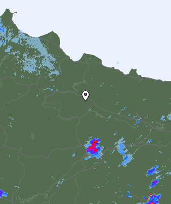 Radar