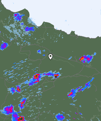 Radar