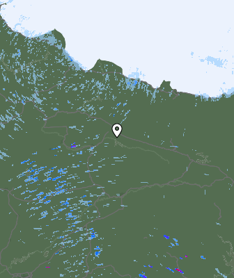 Radar