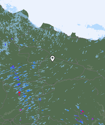 Radar