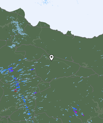 Radar