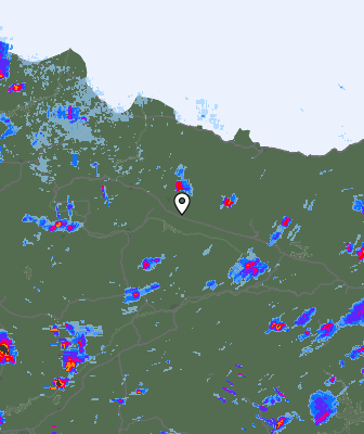 Radar