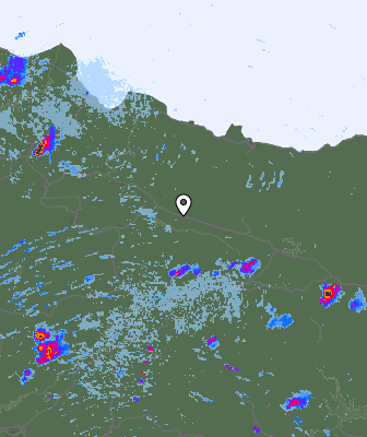 Radar