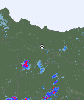 Radar