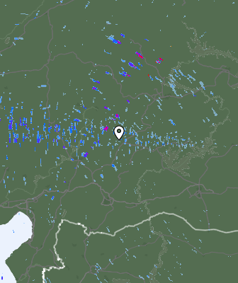 Radar