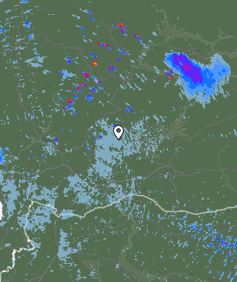 Radar