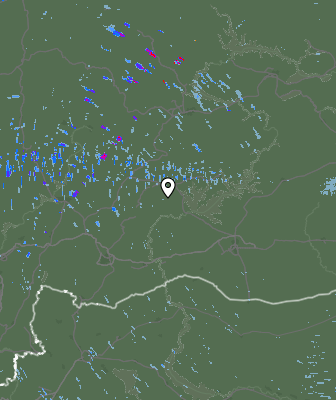 Radar