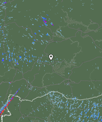 Radar