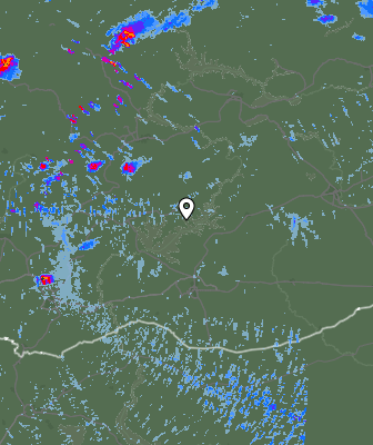 Radar